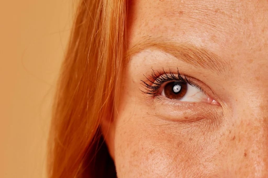 AgeJet vs CO2 Laser Eye Treatments Non-Surgical Blepharoplasty Manchester